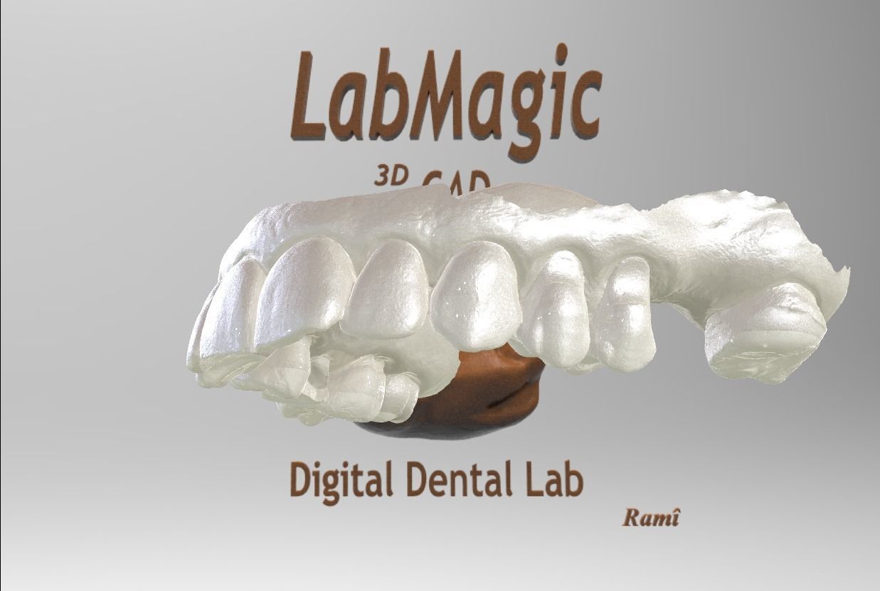 Digital Surgical Guide  3D print model_5