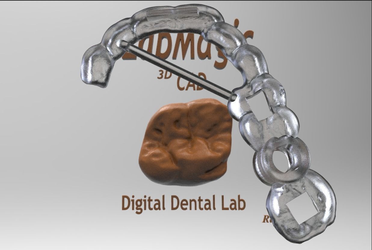 Digital Surgical Guide  3D print model_10