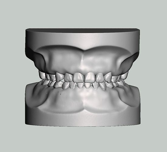 Pediatric dental model 3D print model
