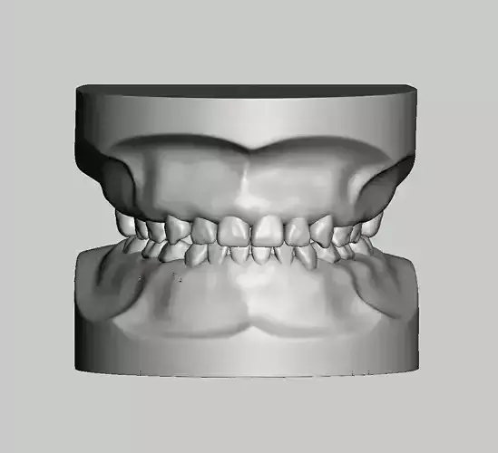 Pediatric dental model 3D print model