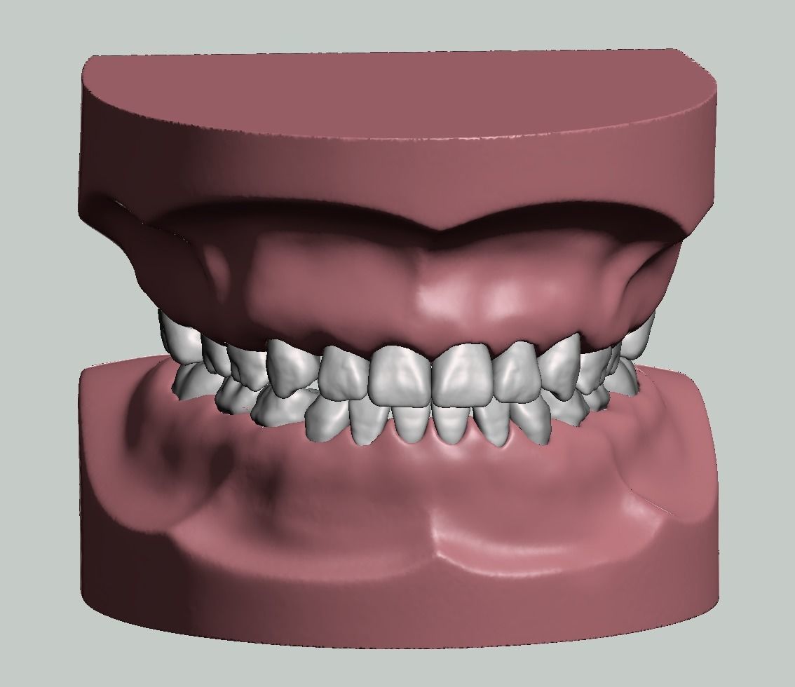 Pediatric dental model with individual teeth 3D print model_3