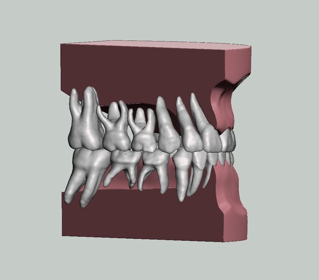 Pediatric dental model with individual teeth 3D print model_2