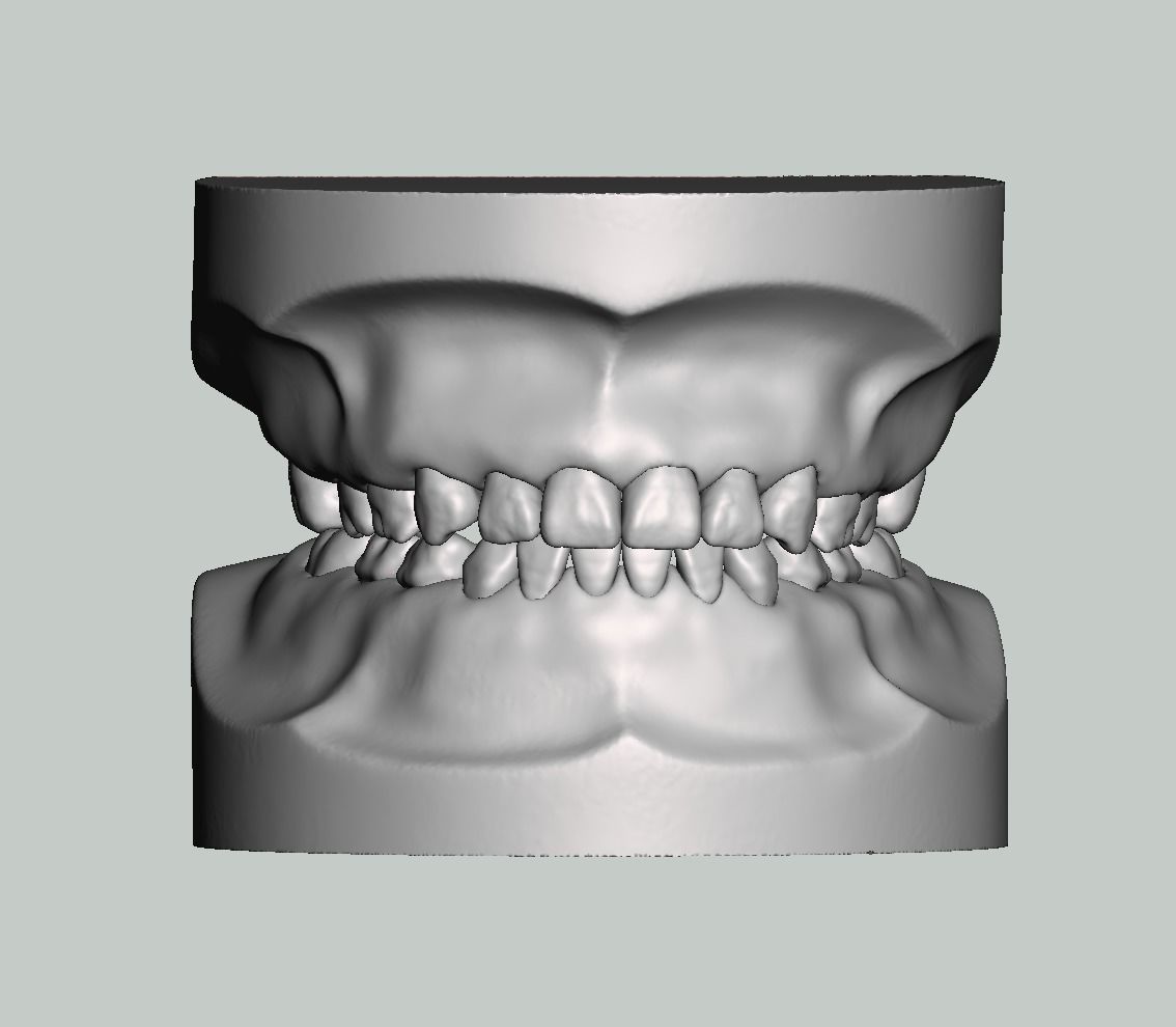 Pediatric dental model with individual teeth 3D print model_1