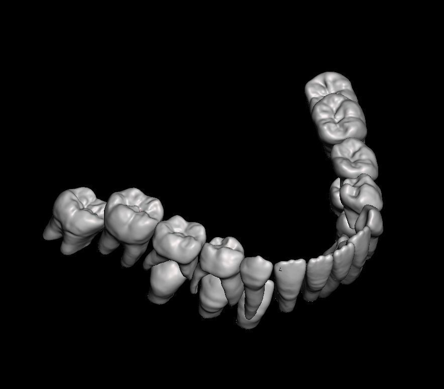 Mix dentition model with individual teeth 3D print model_5