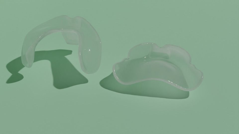 Custom impression trays for edentulous patients 3D model_2