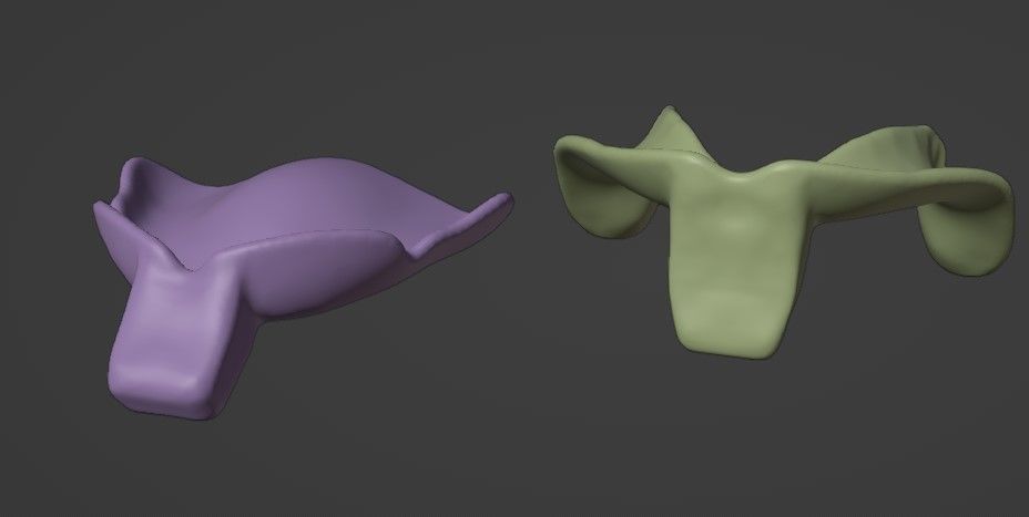 Custom impression trays for edentulous patients 3D model_5