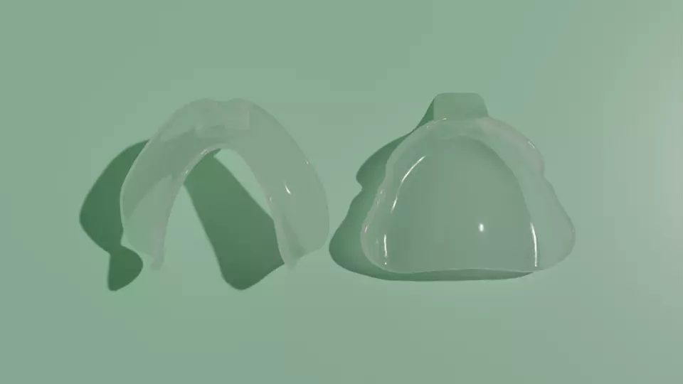 Custom impression trays for edentulous patients 3D model_0