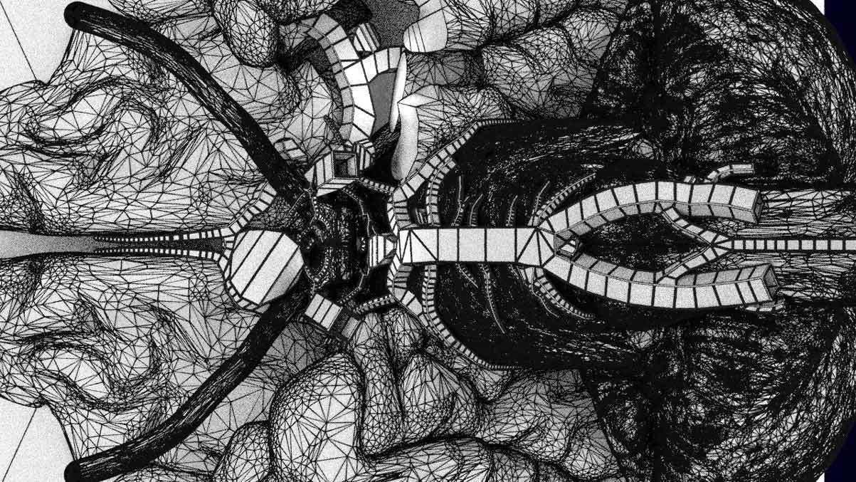 Cerebral aneurysms berry circle of willis 3D model_17