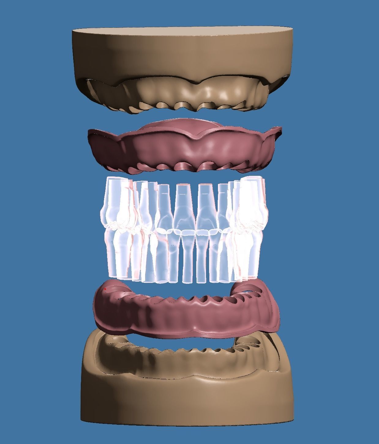 Base and Gum data for dental anatomical typodont 3D print model_3
