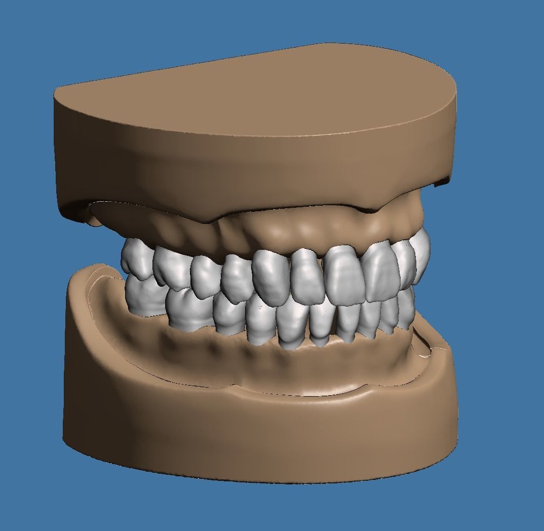 Dental model maxillary and mandibular with soft tissue version 3D Model Collection_5
