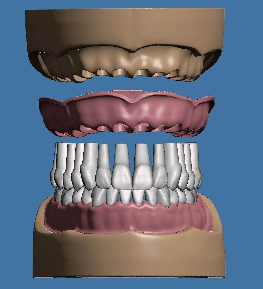 Dental model maxillary and mandibular with soft tissue version 3D Model Collection_7