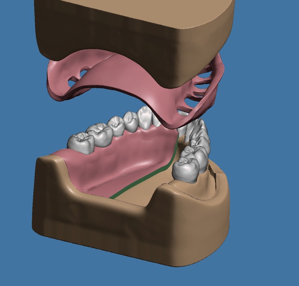 Dental model maxillary and mandibular with soft tissue version 3D Model Collection_6