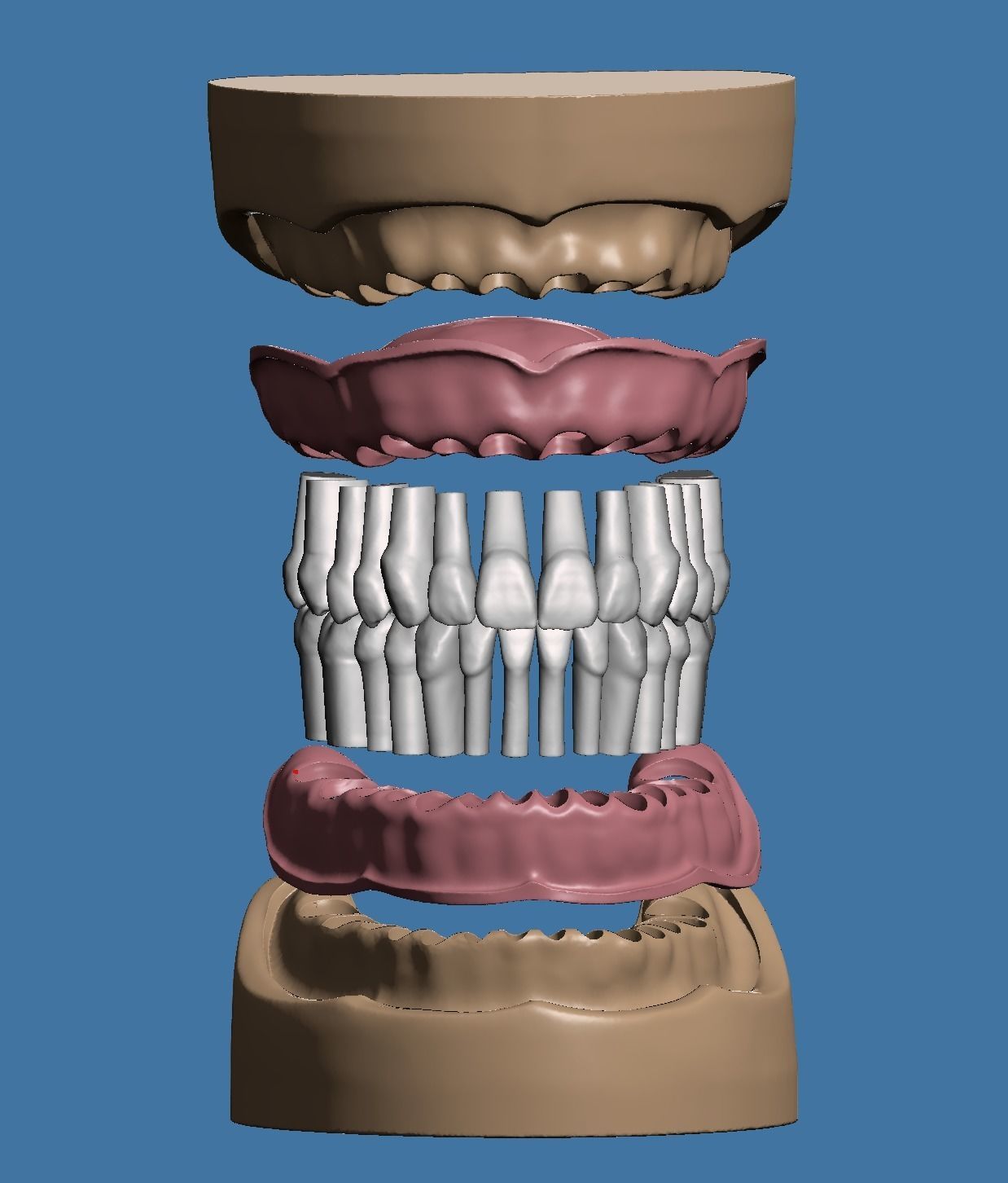 Dental model maxillary and mandibular with soft tissue version 3D Model Collection_1