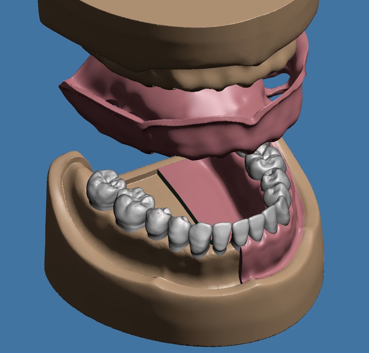 Dental model maxillary and mandibular with soft tissue version 3D Model Collection_2