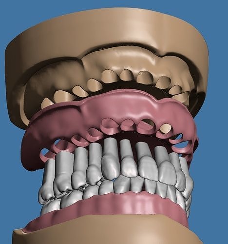 Dental model maxillary and mandibular with soft tissue version 3D Model Collection