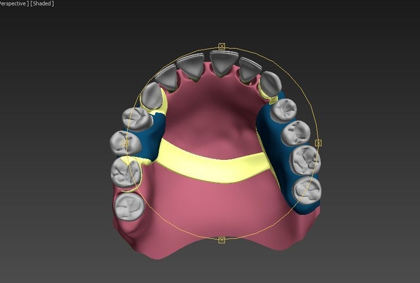 Quatrotty denture 3D model_2