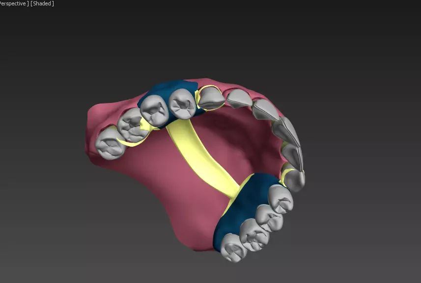 Quatrotty denture 3D model_0