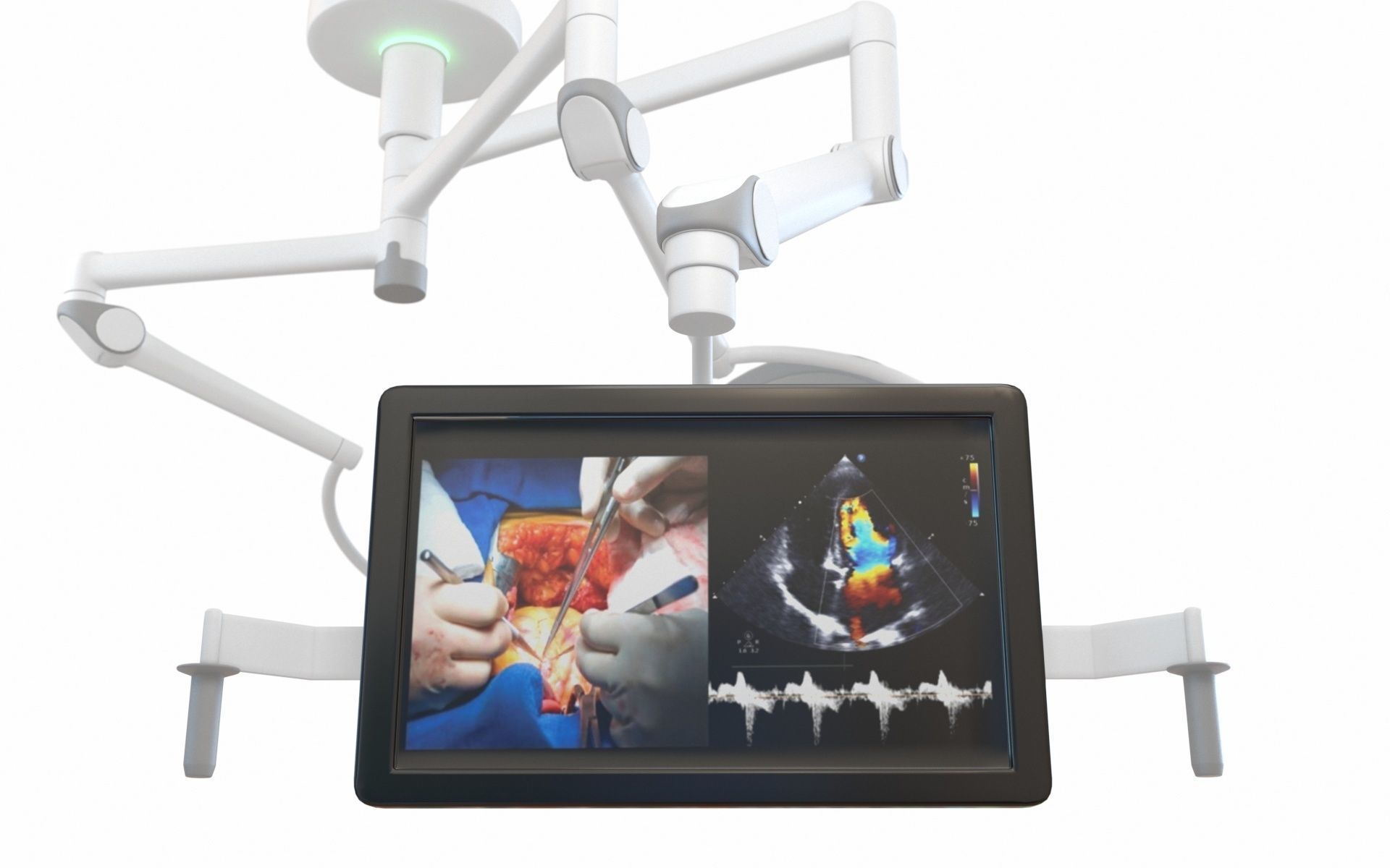 Surgical Light Low-poly 3D model_18