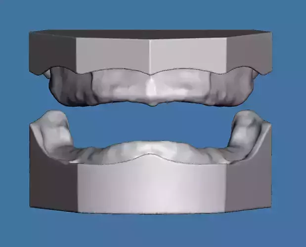 Edentulous scan model maxillary and mandibular 3D print model
