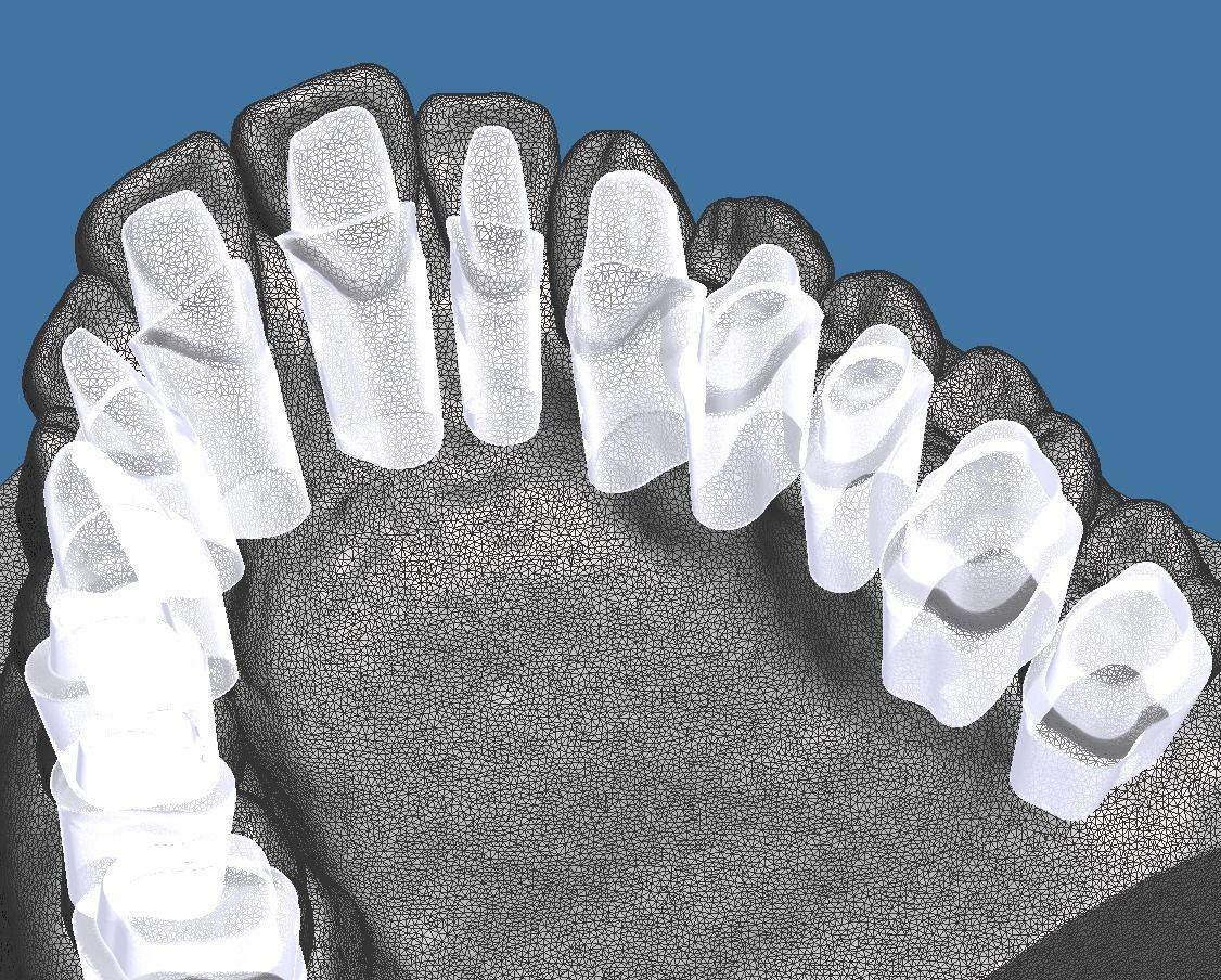 Full die set dental sample model maxillar 3D print model_12