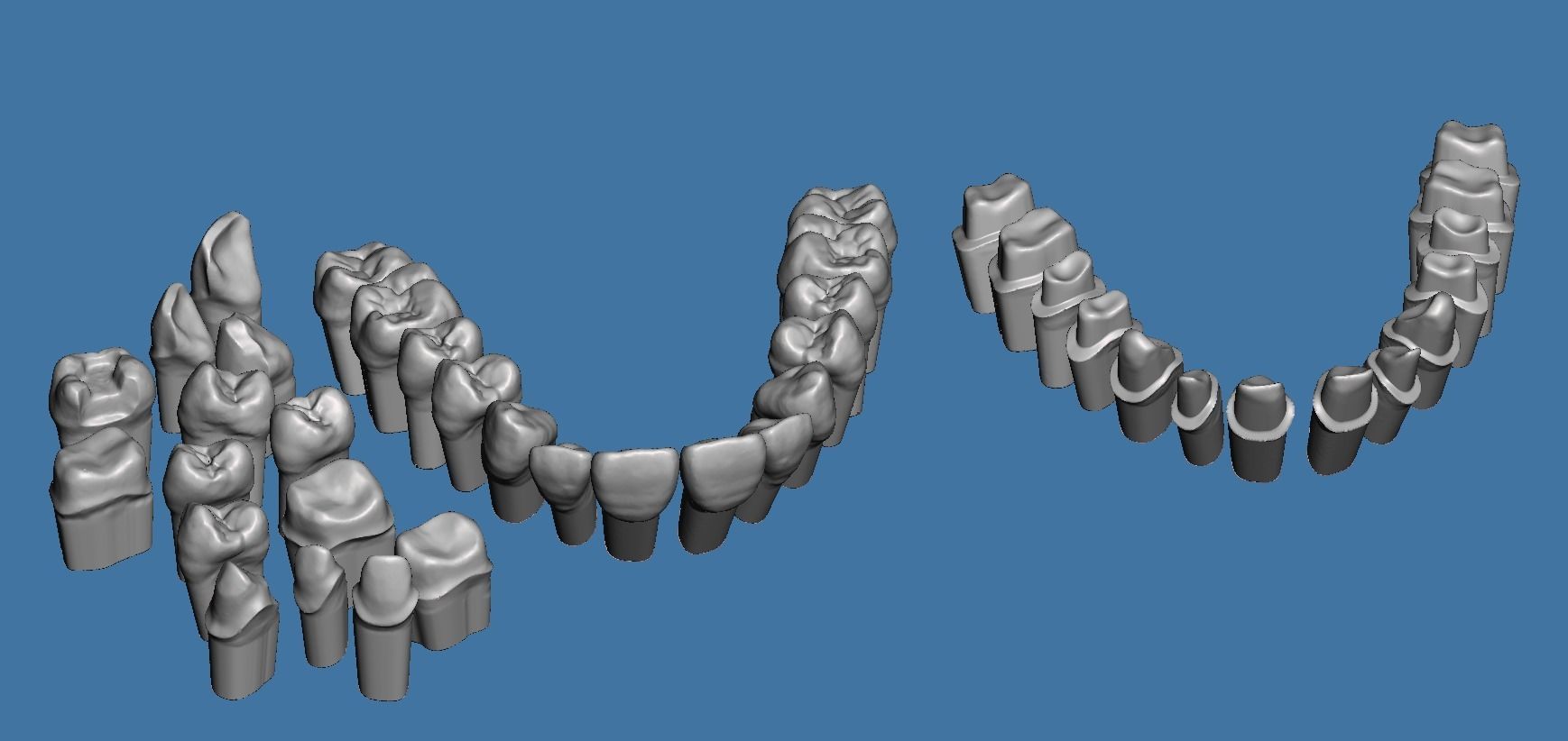 Full die set dental sample model maxillar 3D print model_16