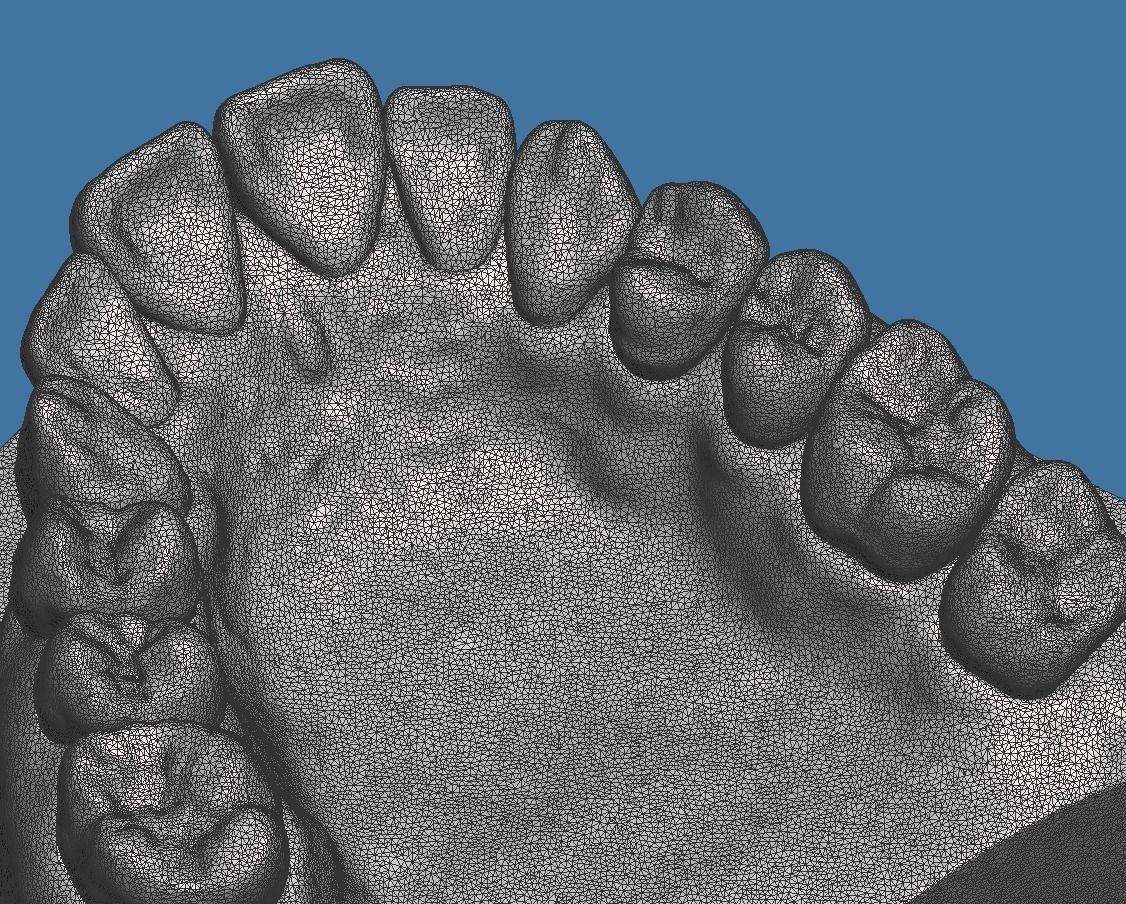 Full die set dental sample model maxillar 3D print model_11