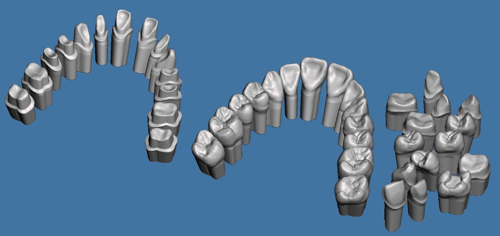 Full die set dental sample model maxillar 3D print model_5