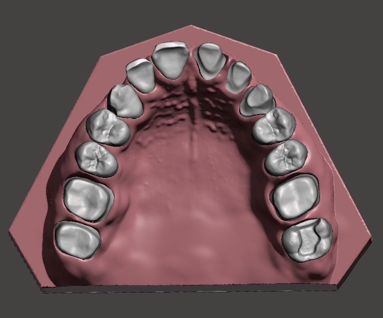 Full die set dental sample model maxillar 3D print model_7