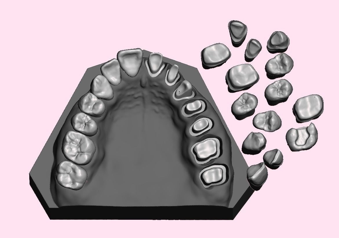 Full die set dental sample model maxillar 3D print model_1
