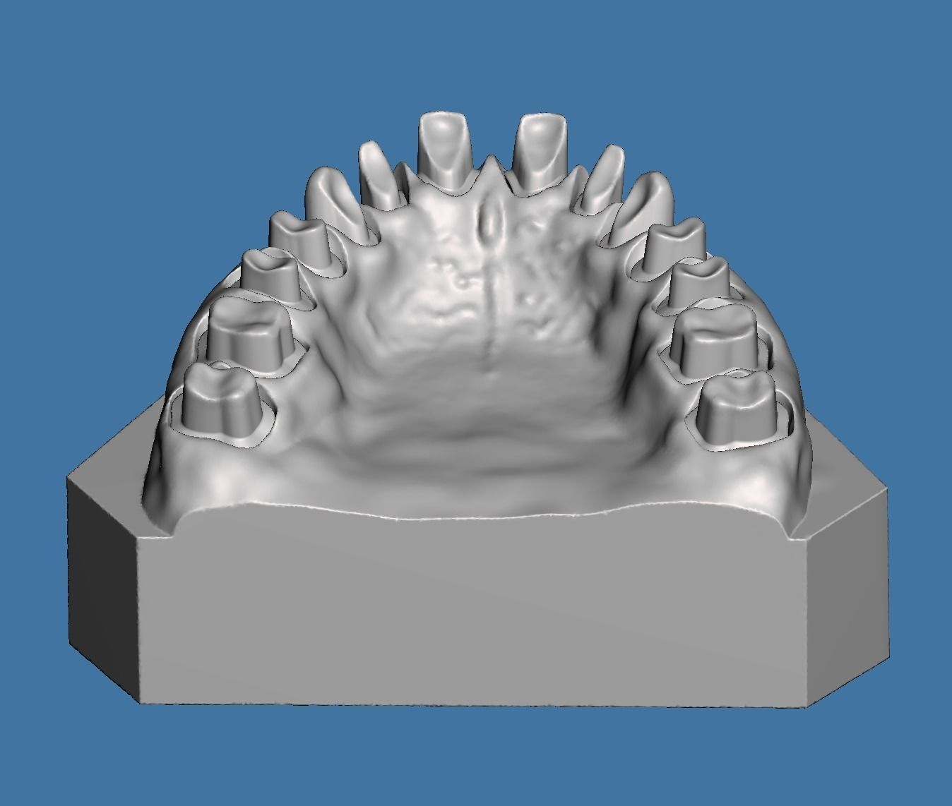Full die set dental sample model maxillar 3D print model_2