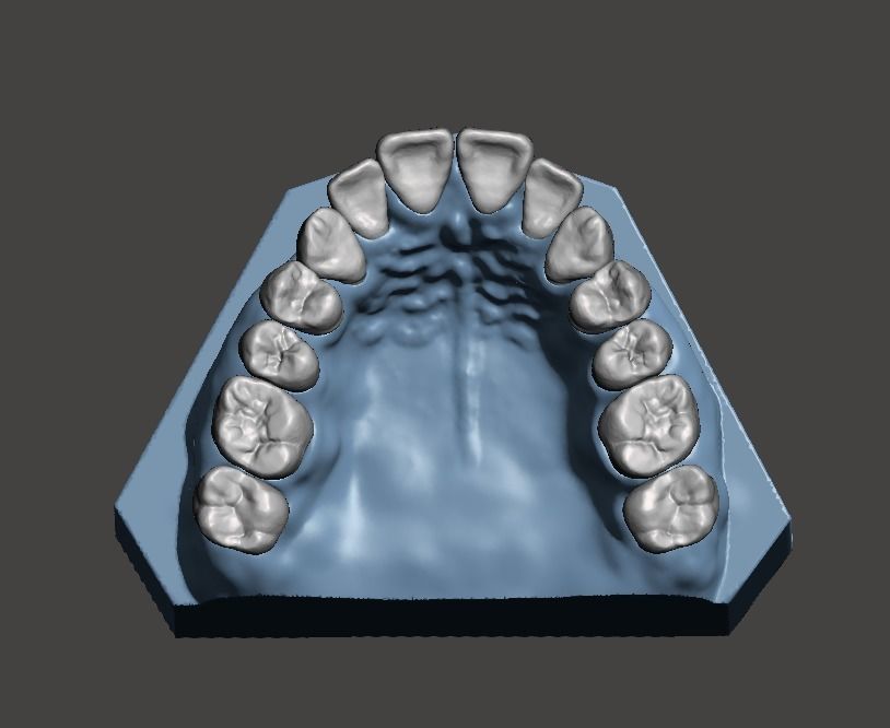 Full die set dental sample model maxillar 3D print model_6
