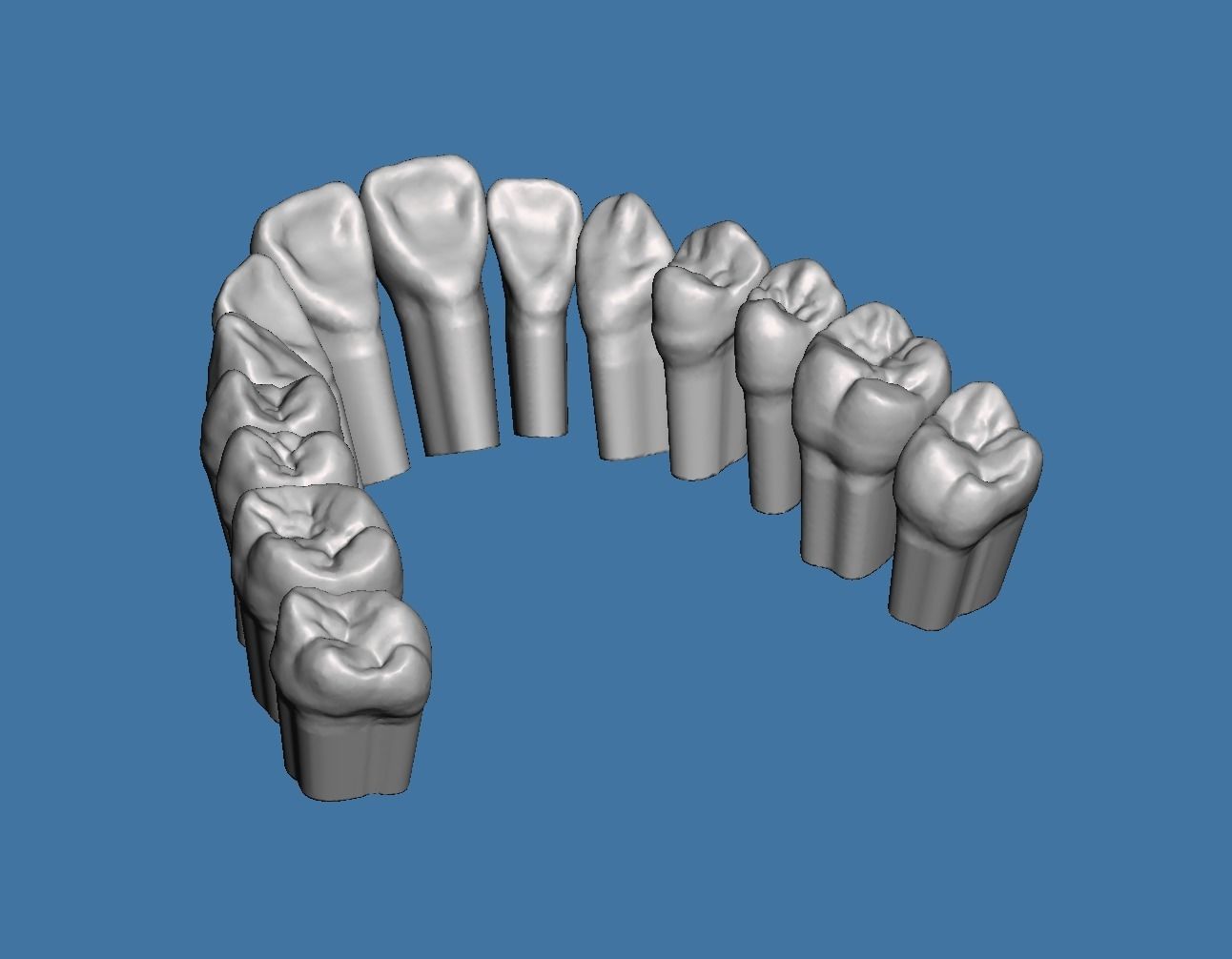 Full die set dental sample model maxillar 3D print model_4