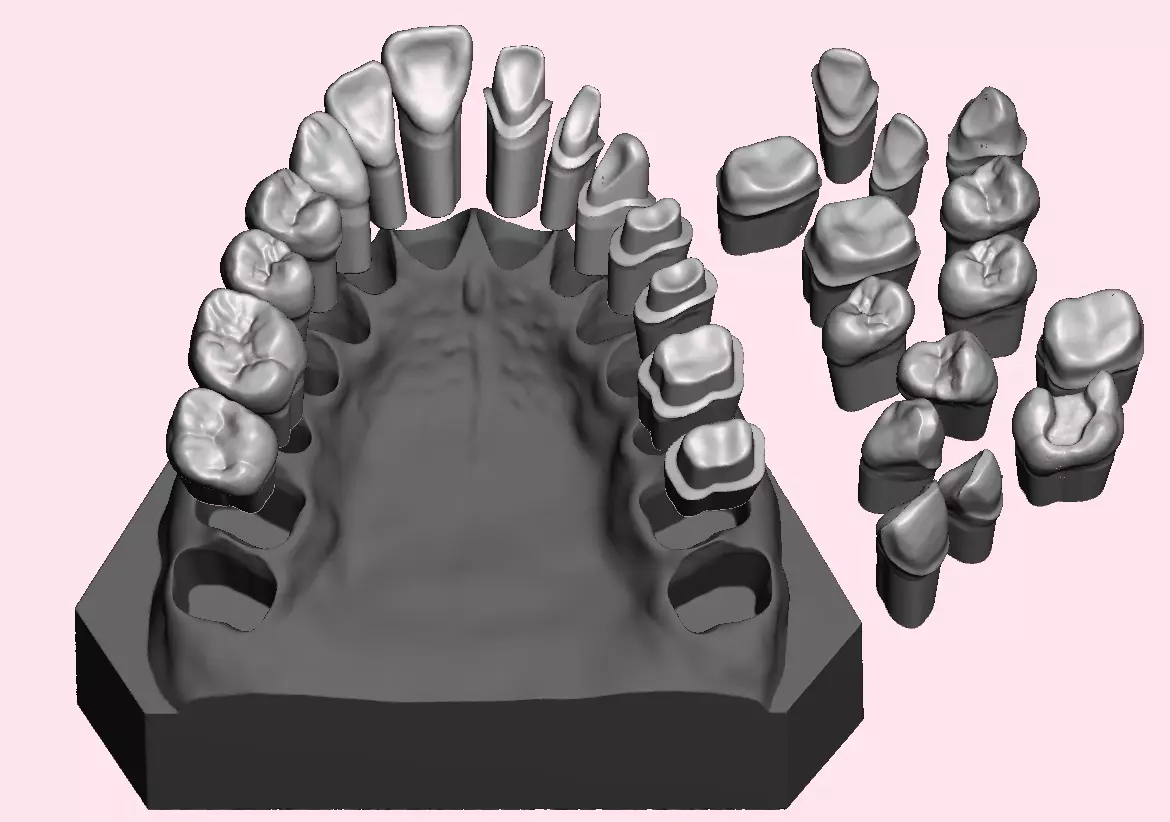 Full die set dental sample model maxillar 3D print model_0