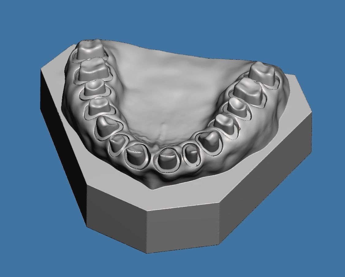 Full die set dental sample model maxillar 3D print model_9