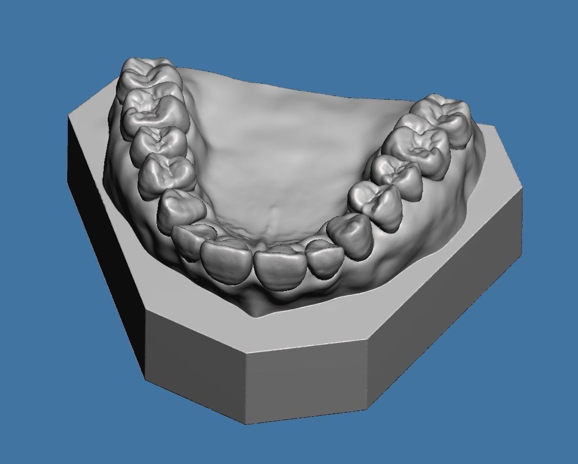 Full die set dental sample model maxillar 3D print model_10