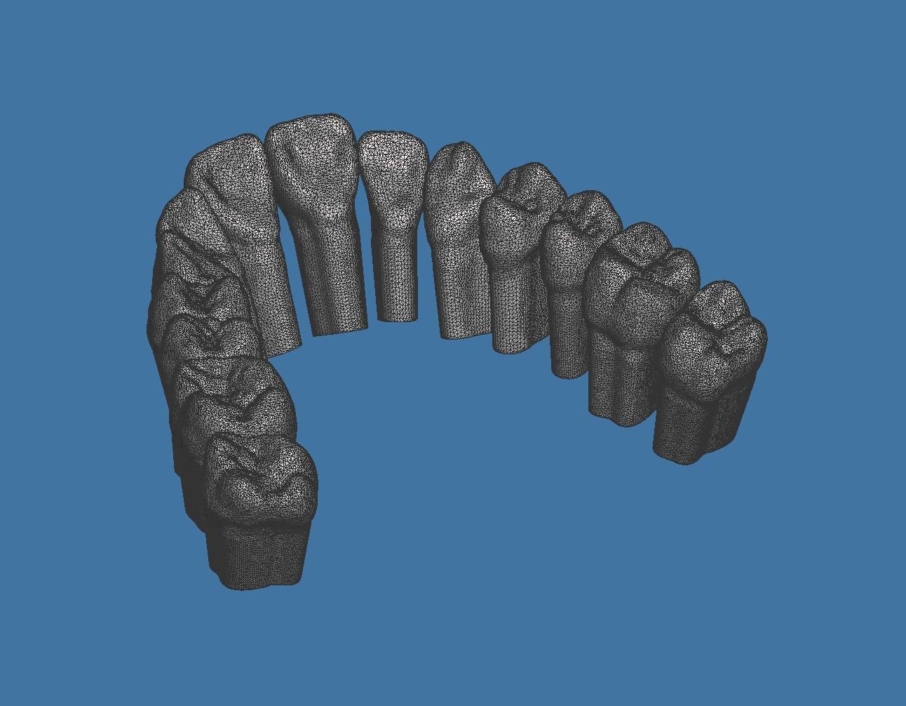 Full die set dental sample model maxillar 3D print model_14