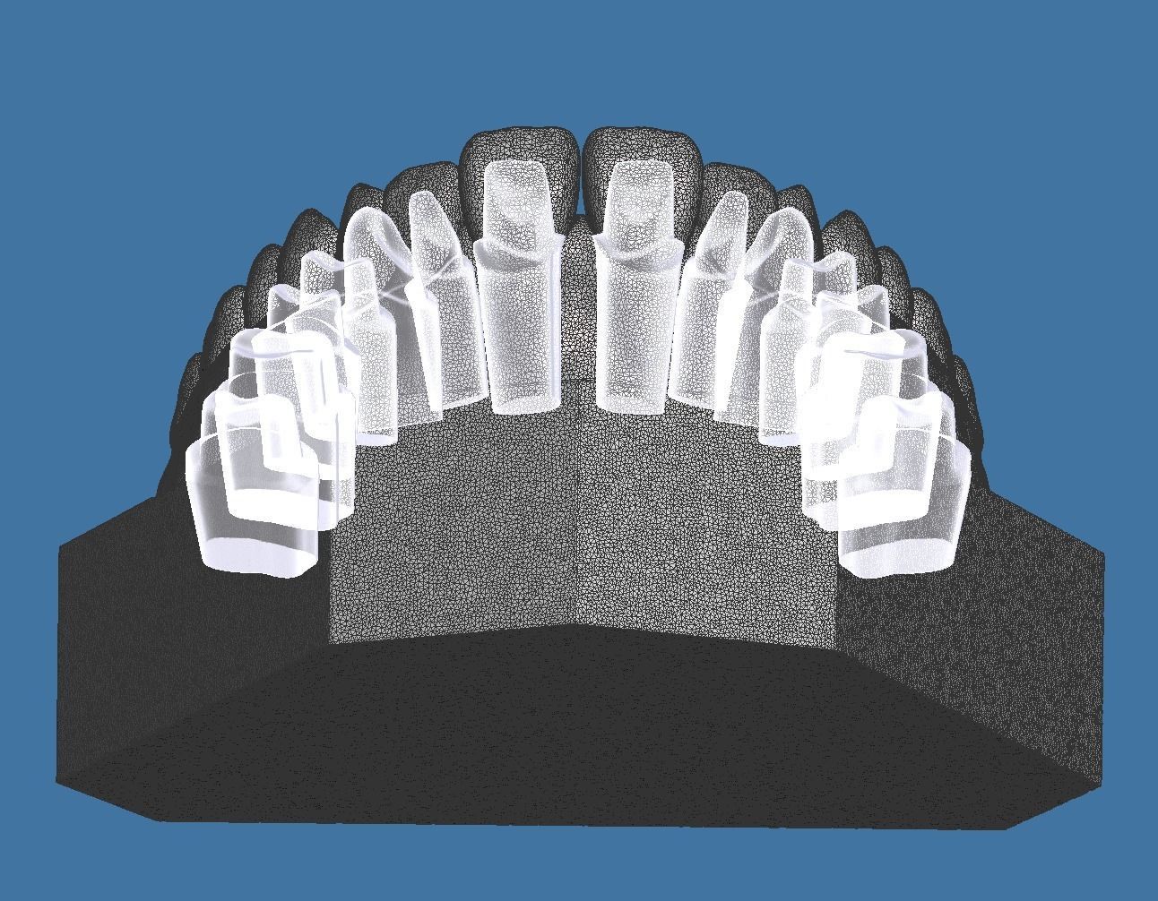 Full die set dental sample model maxillar 3D print model_13