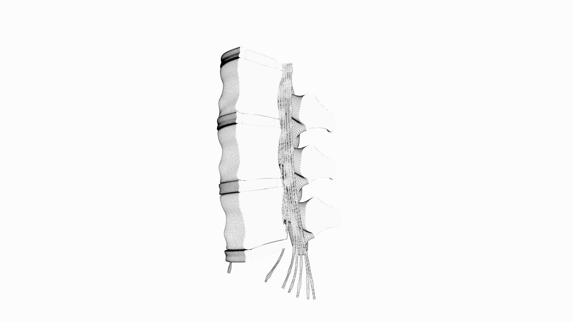 Slipped Bulging Herniated Herniation Disc Spine 3D model_34