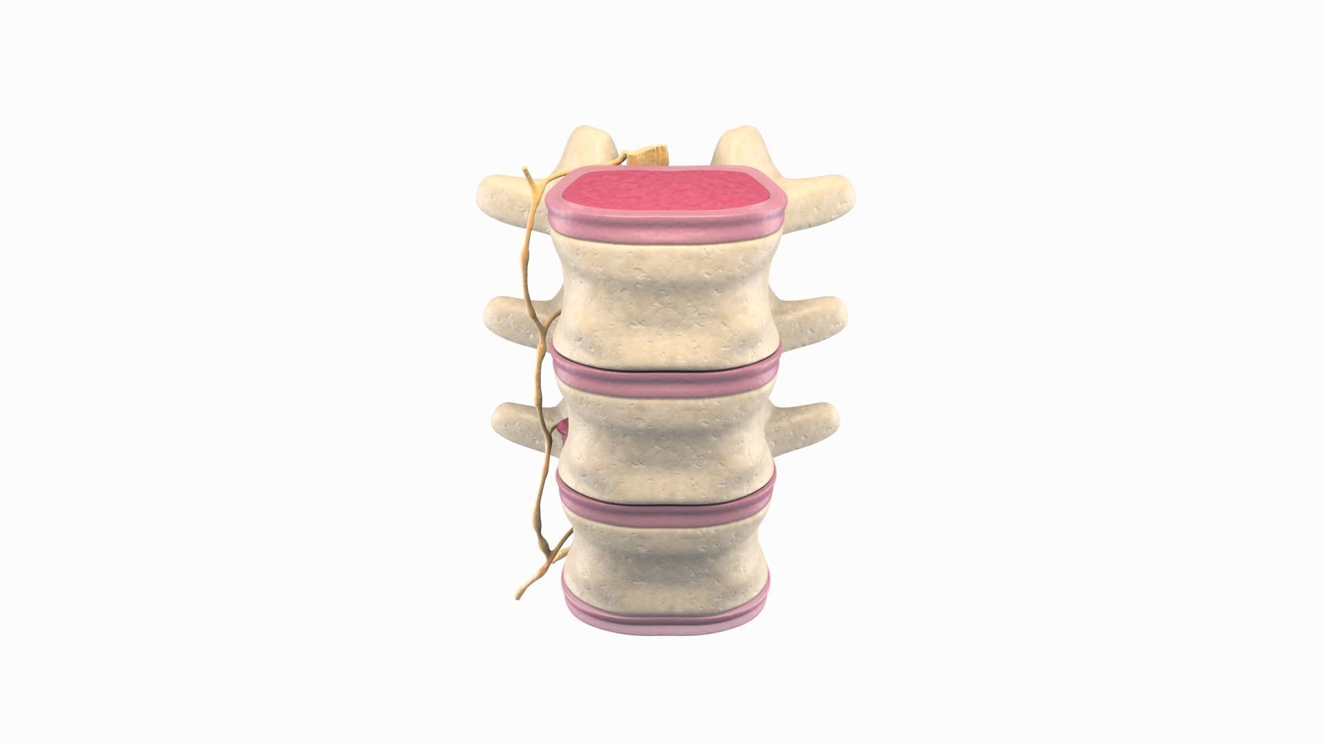 Slipped Bulging Herniated Herniation Disc Spine 3D model_15