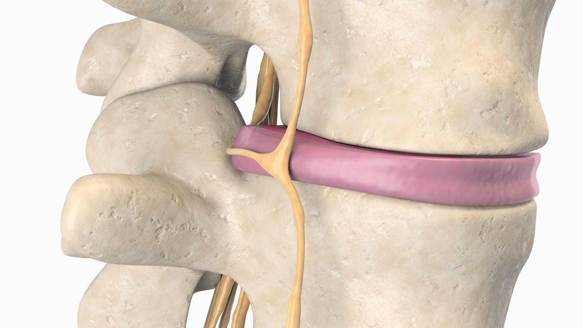 Slipped Bulging Herniated Herniation Disc Spine 3D model_23