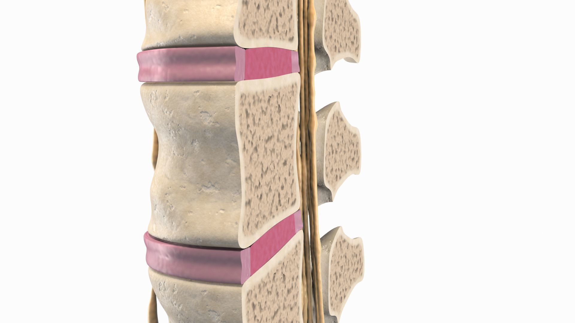 Slipped Bulging Herniated Herniation Disc Spine 3D model_13