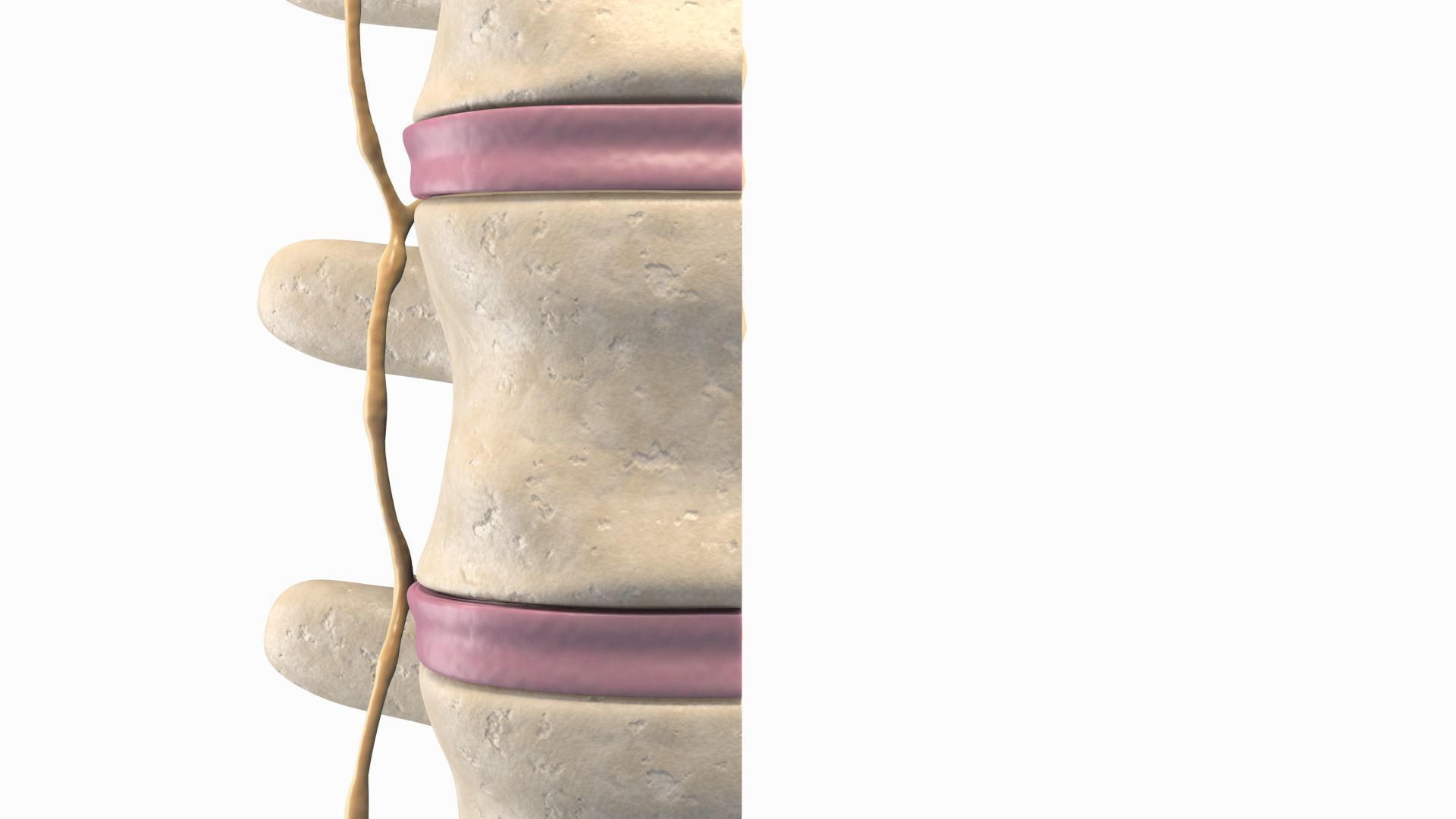 Slipped Bulging Herniated Herniation Disc Spine 3D model_14