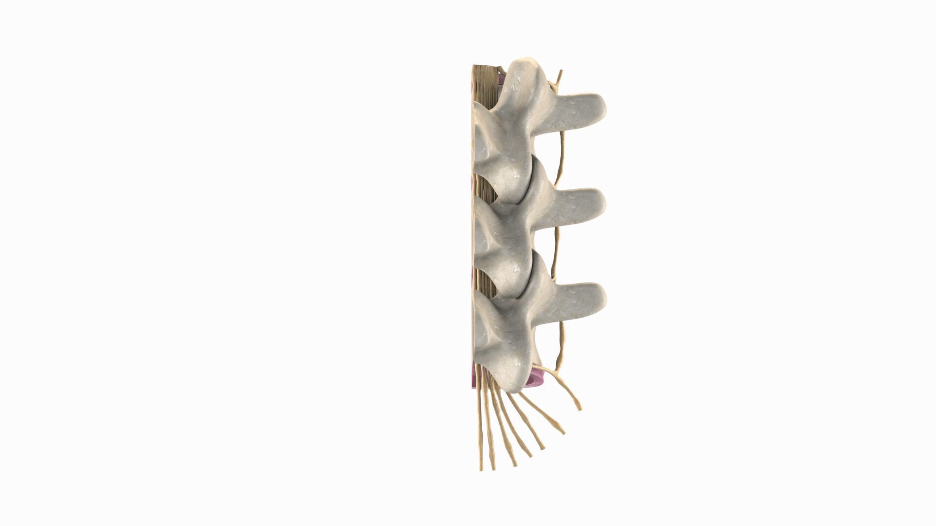 Slipped Bulging Herniated Herniation Disc Spine 3D model_5