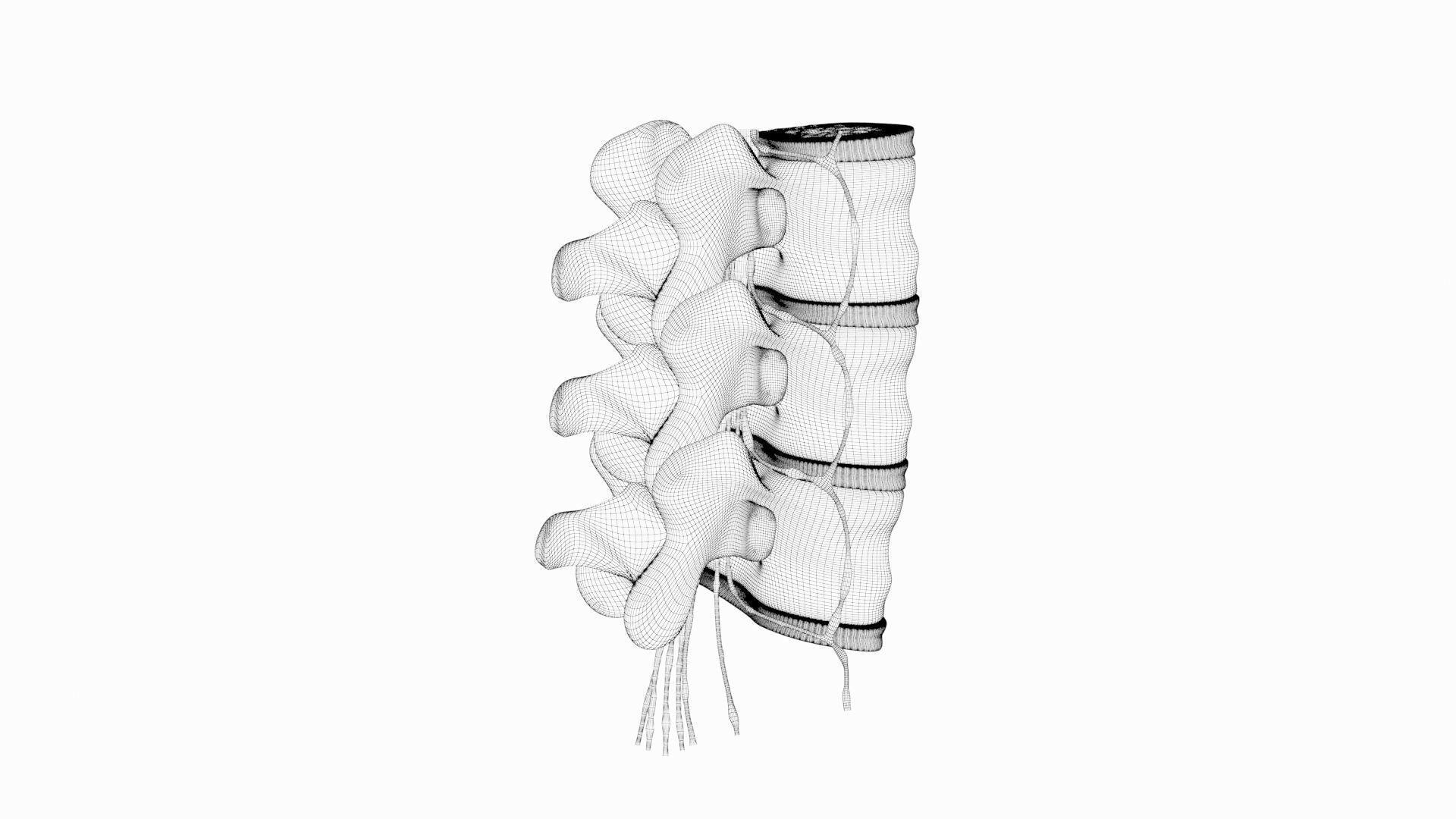 Slipped Bulging Herniated Herniation Disc Spine 3D model_45