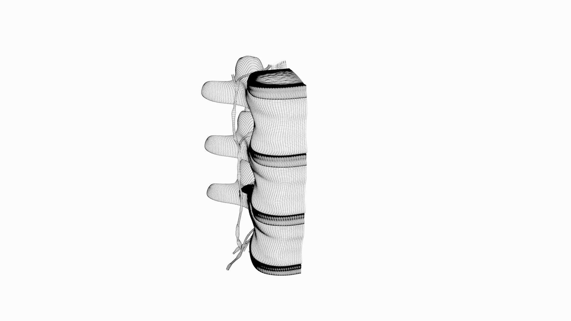 Slipped Bulging Herniated Herniation Disc Spine 3D model_29