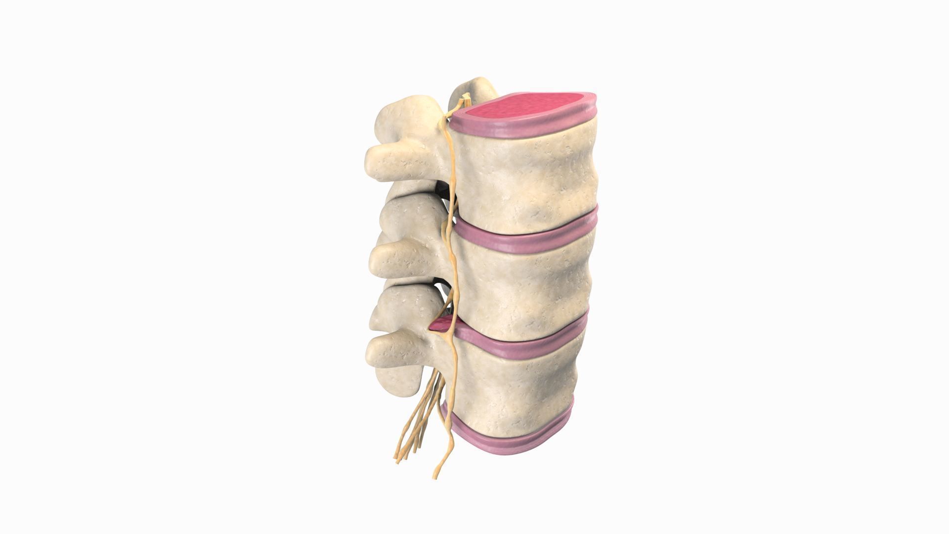 Slipped Bulging Herniated Herniation Disc Spine 3D model_17