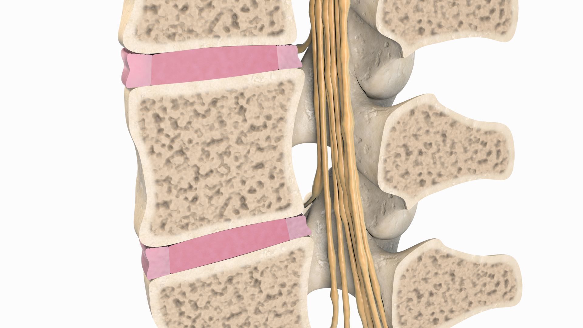 Slipped Bulging Herniated Herniation Disc Spine 3D model_12