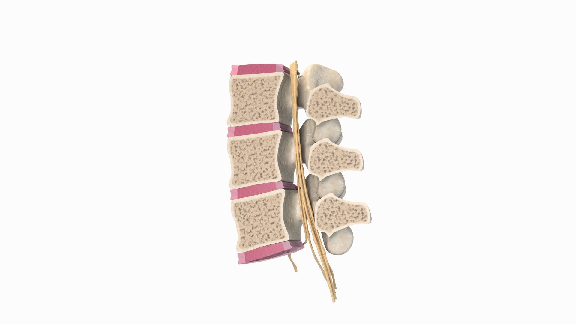 Slipped Bulging Herniated Herniation Disc Spine 3D model_6