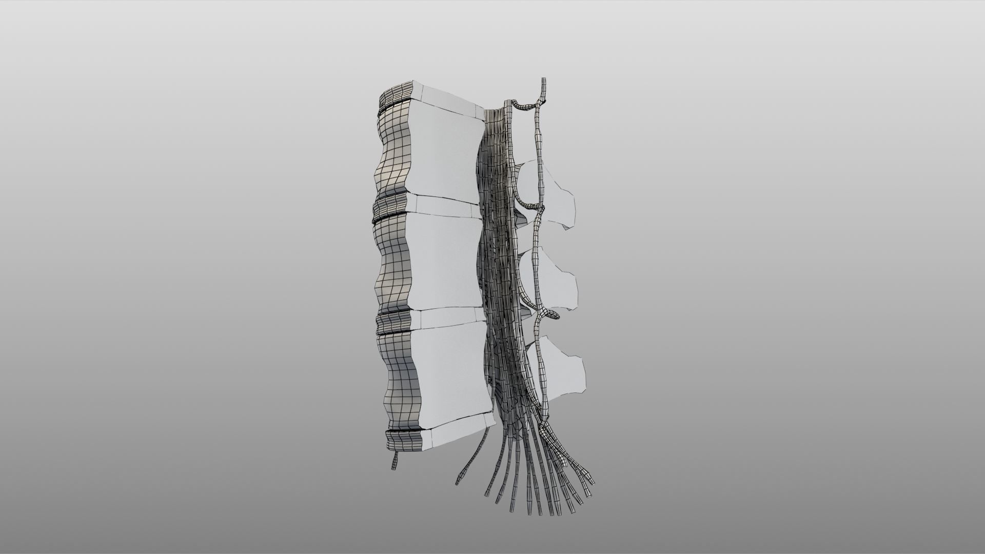 Slipped Bulging Herniated Herniation Disc Spine 3D model_49