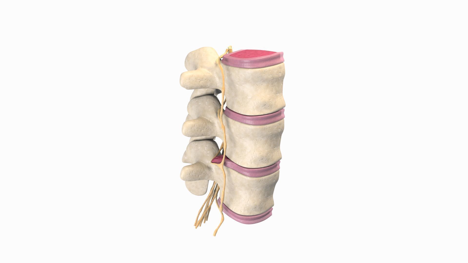 Slipped Bulging Herniated Herniation Disc Spine 3D model_3